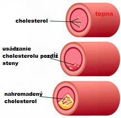 érzáródás